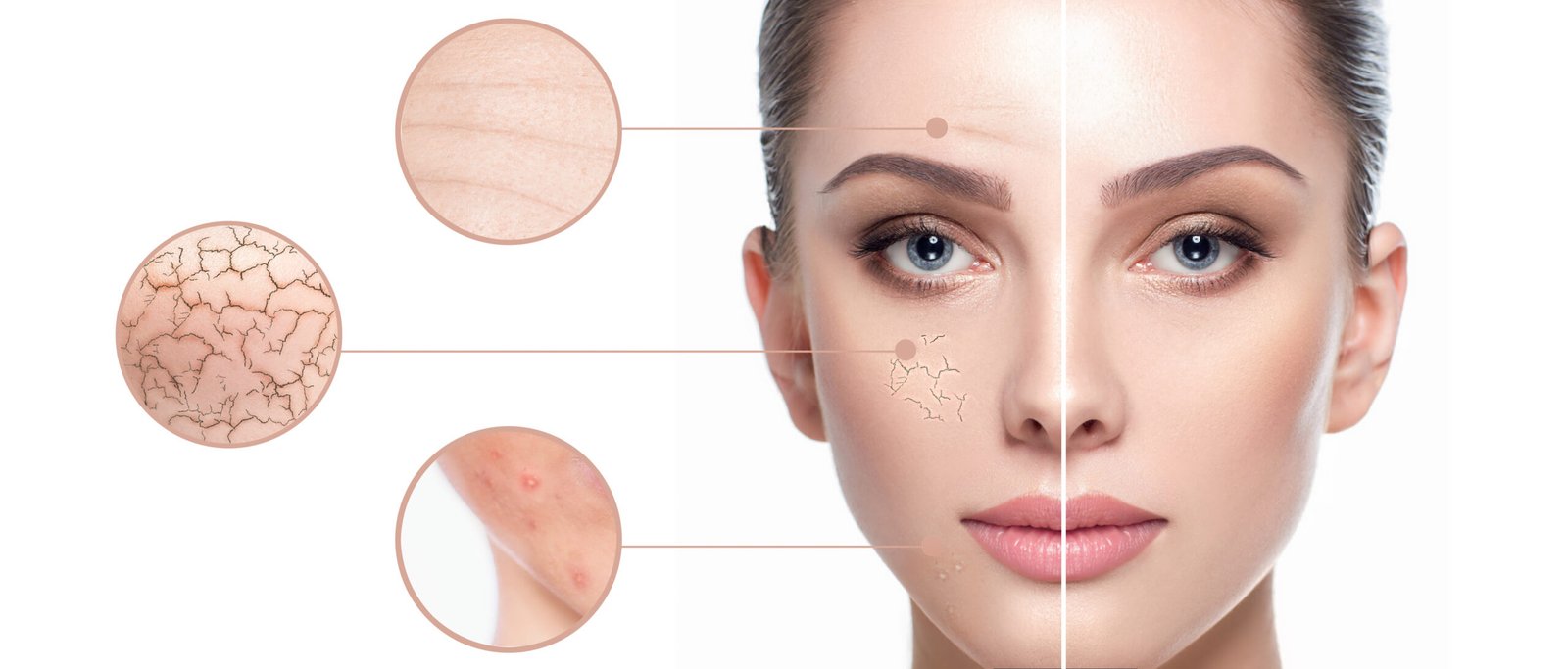 Scar Reduction in Manchester