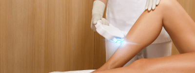 Laser hair removal on leg