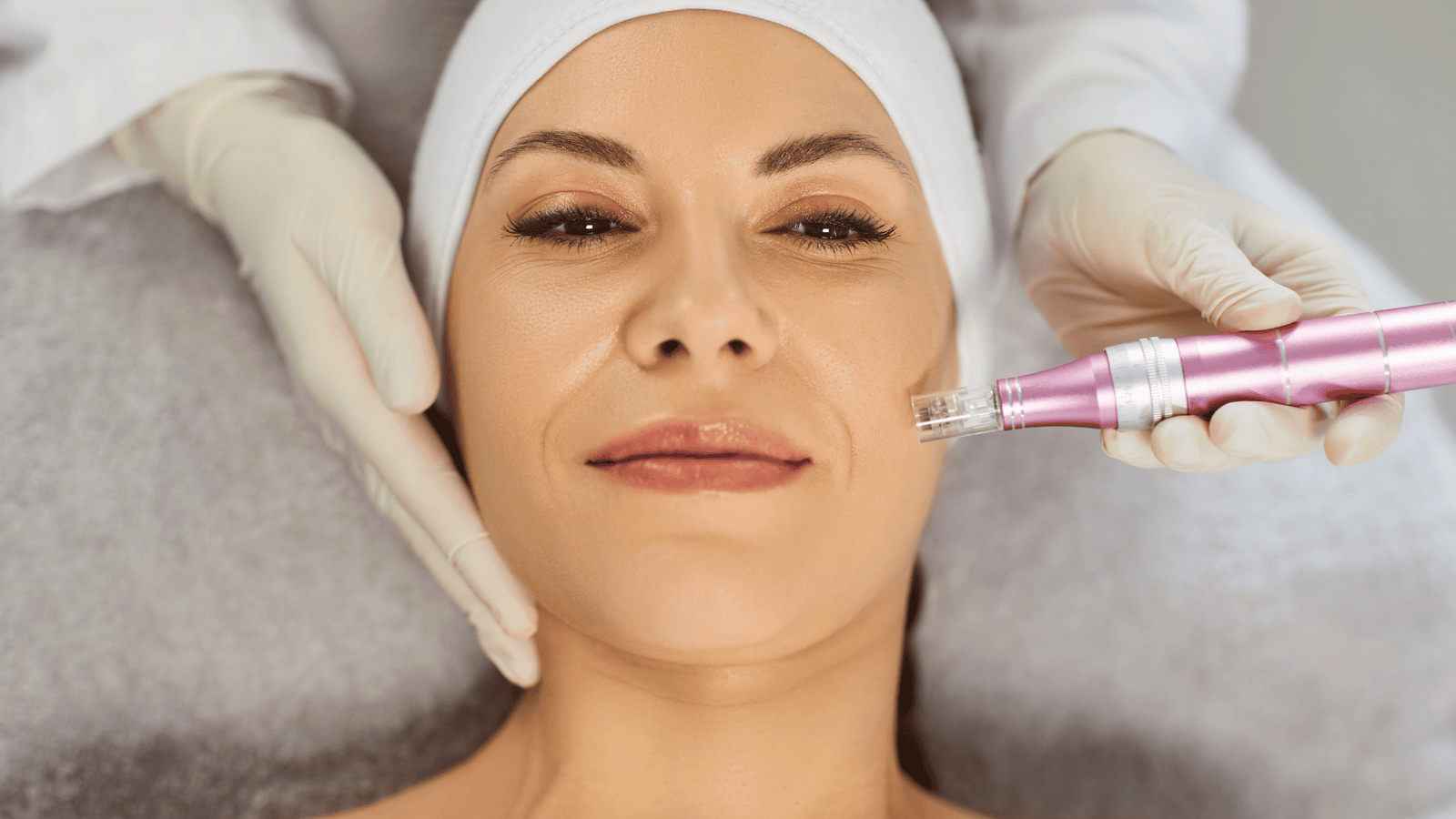 chemical-peels-manchester-which-peel-is-right-for-your-skin