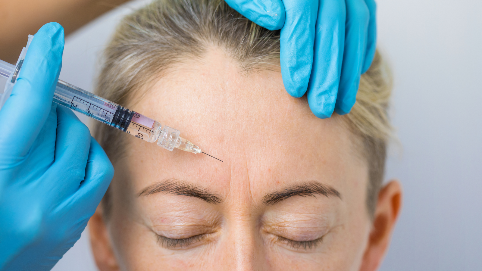 Botox First Time