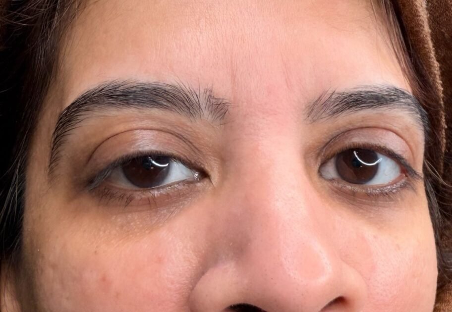 B&A polynucleotides under eye in Manchester
