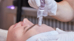 CO2 laser and microneedling treatment comparison for acne scars at Manchester Aesthetics