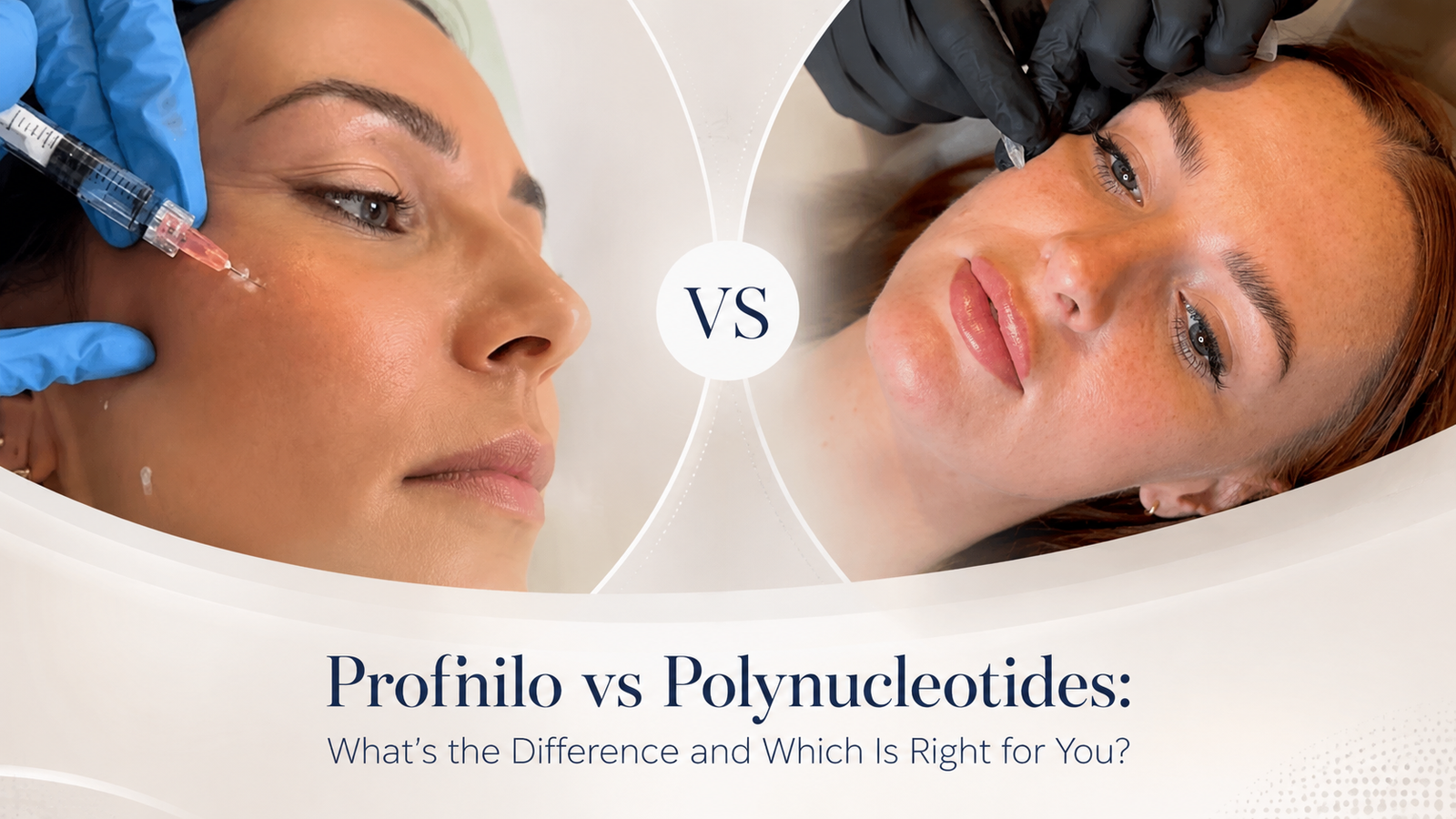 Profhilo vs Polynucleotides comparison graphic showing two women receiving injectable skin treatments, with the headline “What’s the Difference and Which Is Right for You?