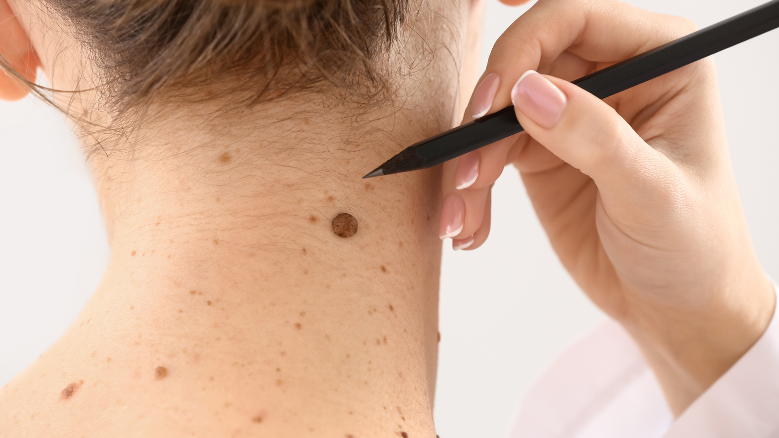 Mole Removal Methods Manchester