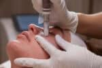 menopausal skin treatment